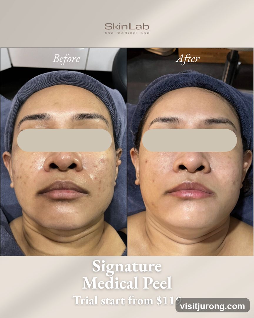 SkinLab The Medical Spa (Westgate) - Acne Facial, Sensitive Skincare, IPL Treatment & Pigmentation Treatment Singapore