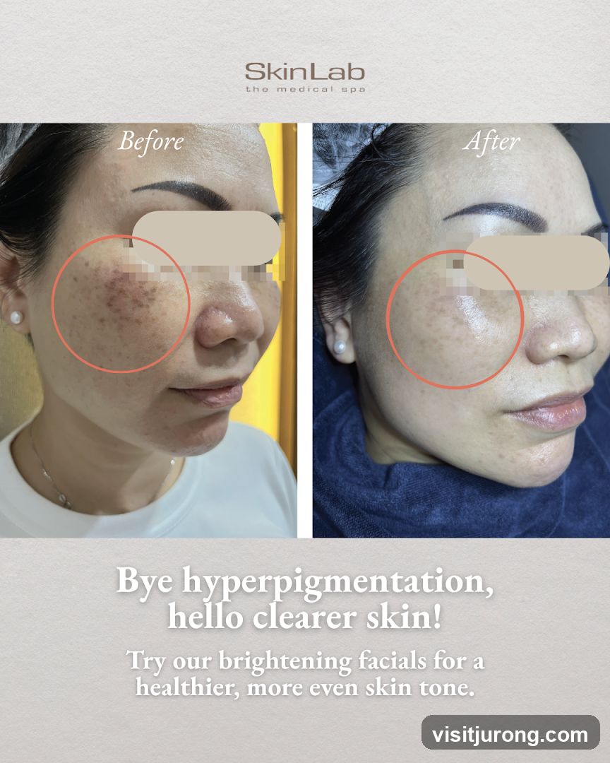SkinLab The Medical Spa (Westgate) - Acne Facial, Sensitive Skincare, IPL Treatment & Pigmentation Treatment Singapore