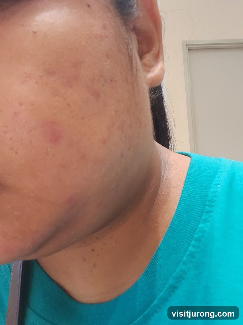 Close-up of a person's face and neck