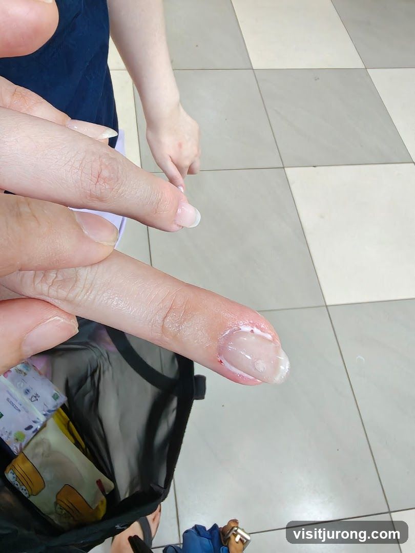 Nail Care