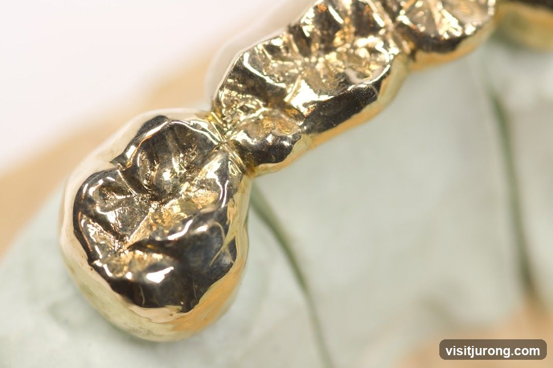 Gold Dental Crown