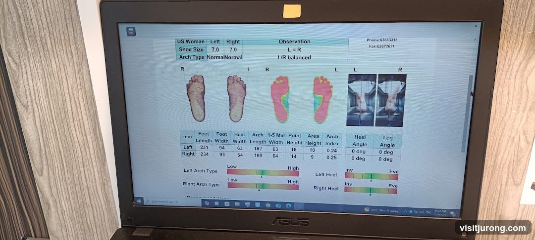 Foot Scan Analysis