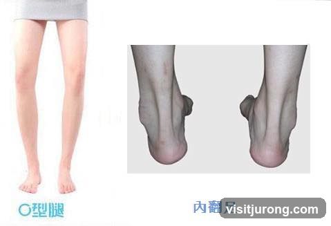 Leg and Foot Conditions