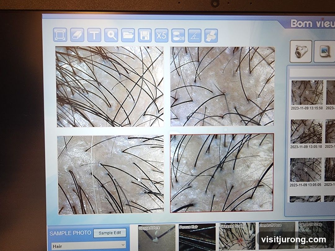 Scalp Analysis Software