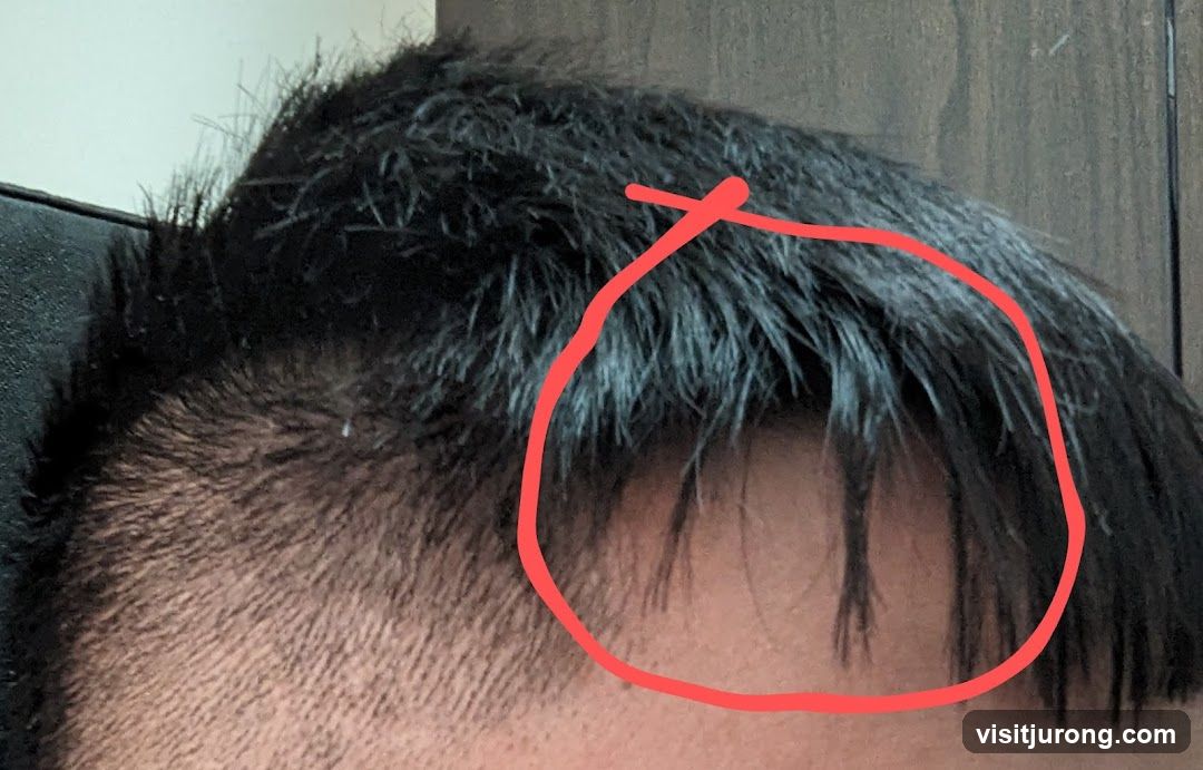 Close-up of hair with a red circle