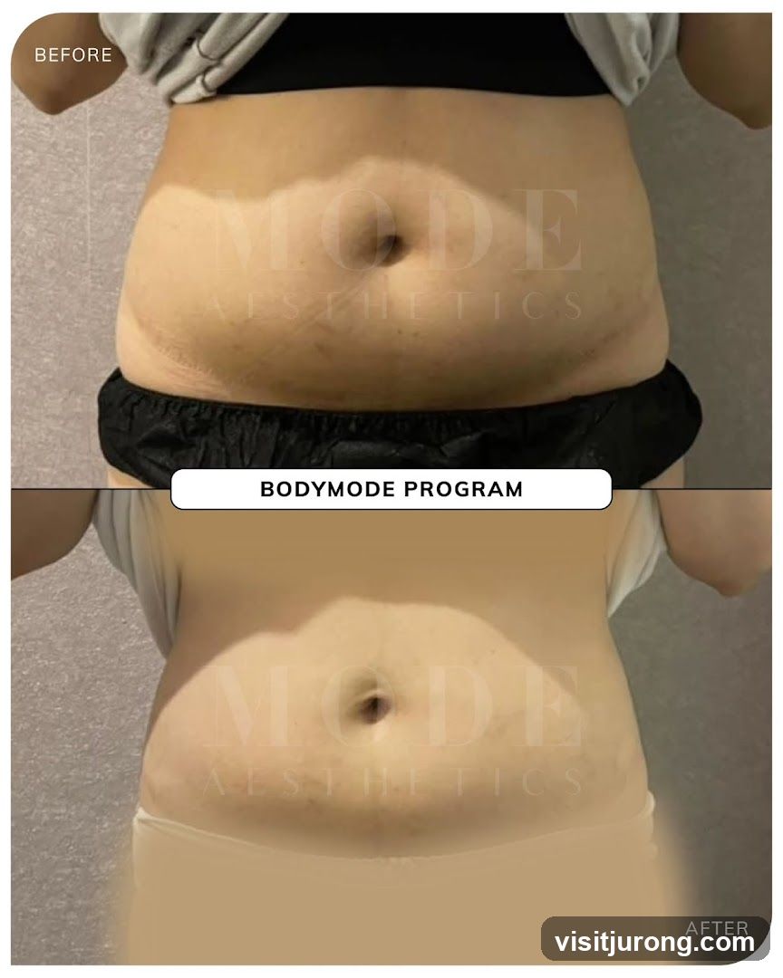 Before and After Bodymode Program