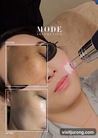 Before and After Skin Treatment