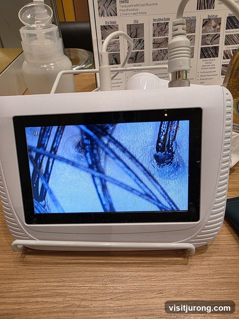 Scalp Analysis Device