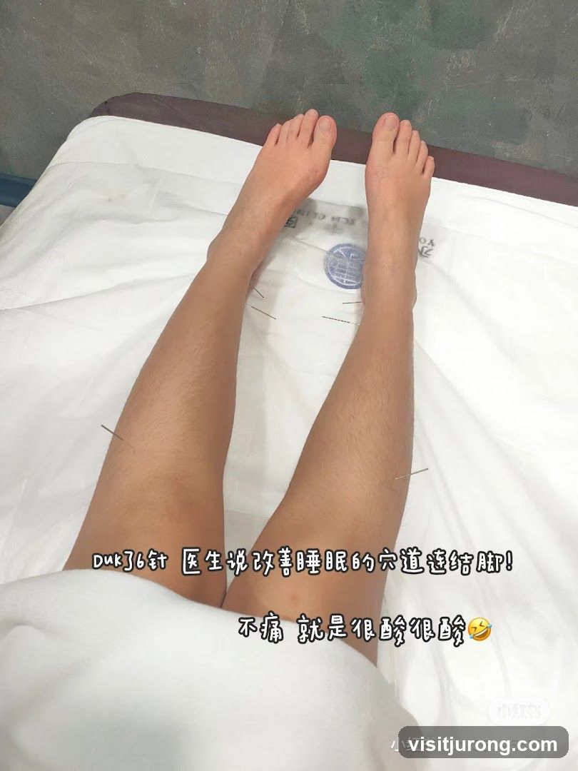 Acupuncture Treatment