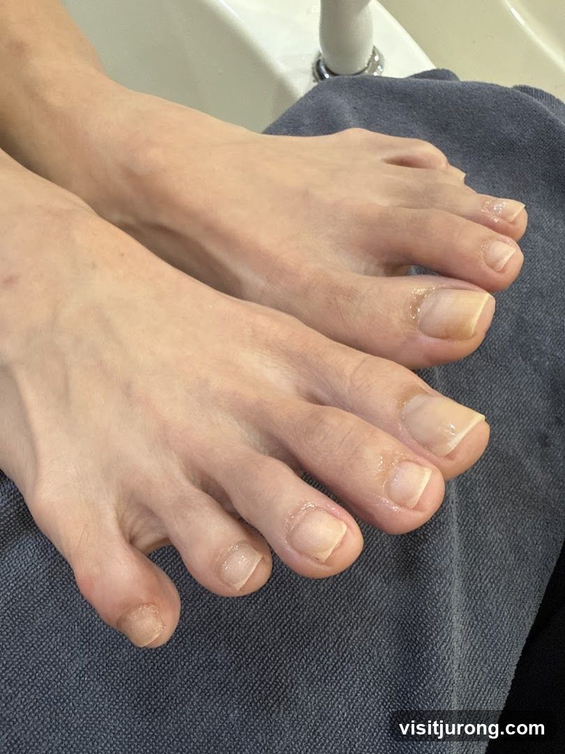 Toes with clear polish
