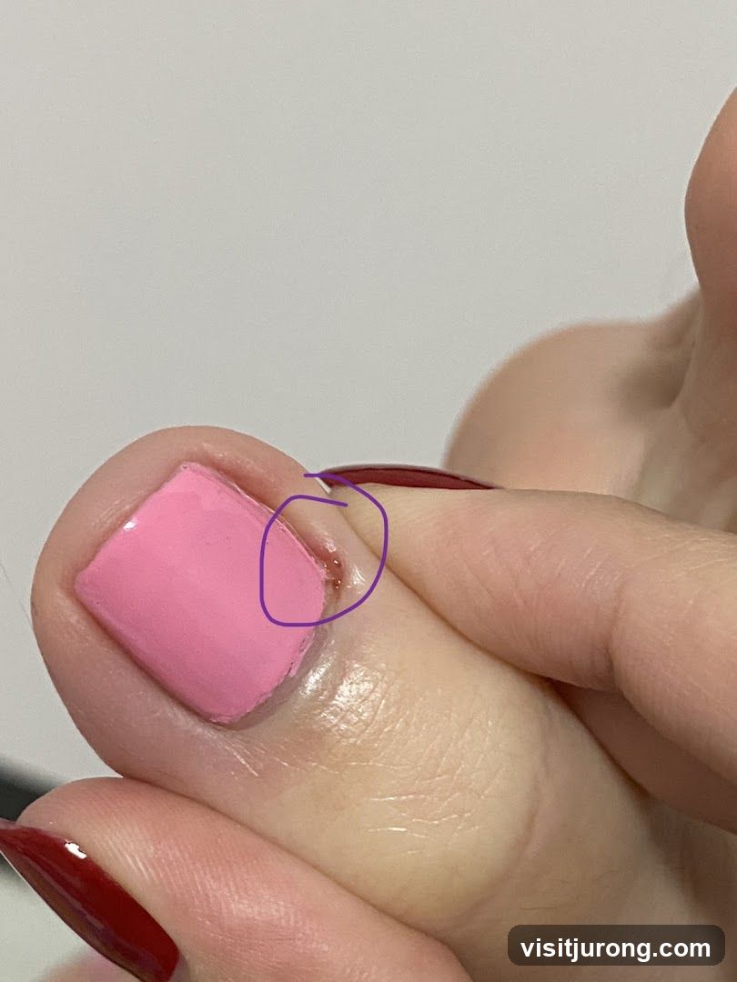 Close-up of a toe with pink nail polish and a small cut